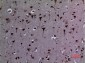 HSP 90 (Acetyl Lys292/284) Polyclonal Antibody